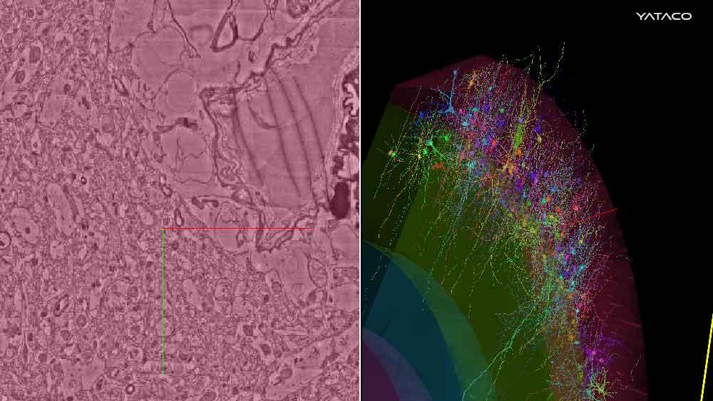 Google y Harvard presentan impresionante mapa del cerebro humano