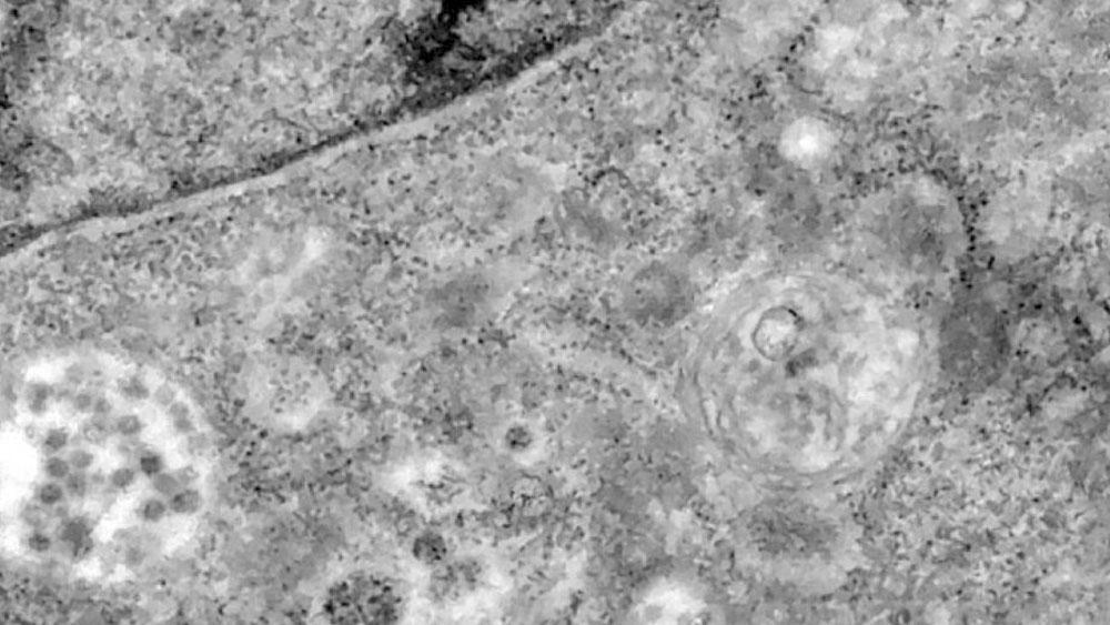 Captan el preciso momento en que el virus infecta una célula